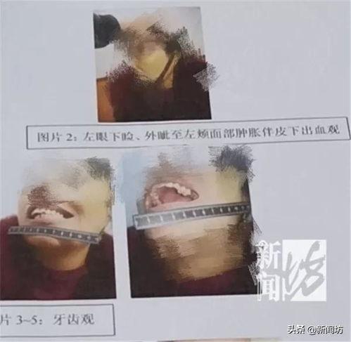 暴躁的吃瓜女子视频播放,现实版“吃瓜群众”